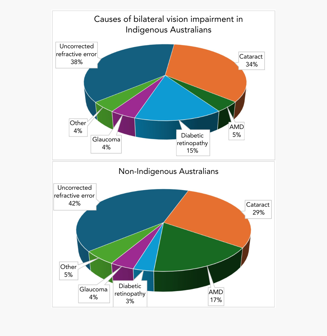Two pie charts compare causes of bilateral vision impairment in Indigenous and non-Indigenous Australians. The top chart, titled “Causes of bilateral vision impairment in Indigenous Australians,” shows: uncorrected refractive error 38% (largest segment), cataract 34%, diabetic retinopathy 15%, age-related macular degeneration (AMD) 5%, glaucoma 4%, and other causes 4%. The bottom chart, titled “Non-Indigenous Australians,” shows: uncorrected refractive error 42% (largest segment), cataract 29%, AMD 17%, diabetic retinopathy 3%, glaucoma 4%, and other causes 5%.
